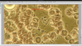 Live Blood Preparation. 250606 Telegram Live Stream 3/7