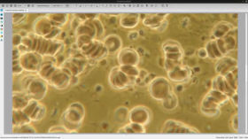 Live Blood Preparation. 250606 Telegram Live Stream 1/7