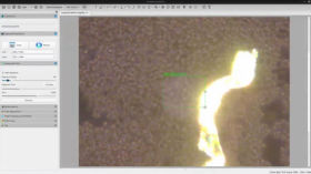 >24hrs ex Live Blood Slide Preparation (LB250606) now with FUNGUS!!!