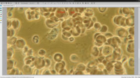 Live Blood Preparation. 250606 Telegram Live Stream 4/7